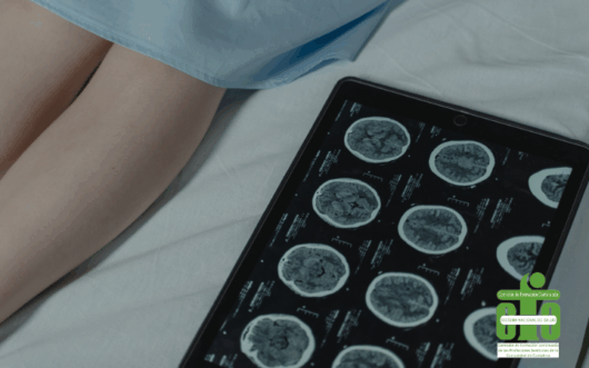 Principios del cuidado del paciente neurológico para el TCAE