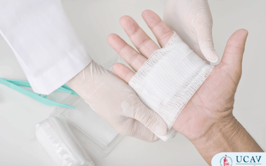 Curso Universitario Técnico en Evaluación y manejo de úlceras cutáneas crónicas para enfermería